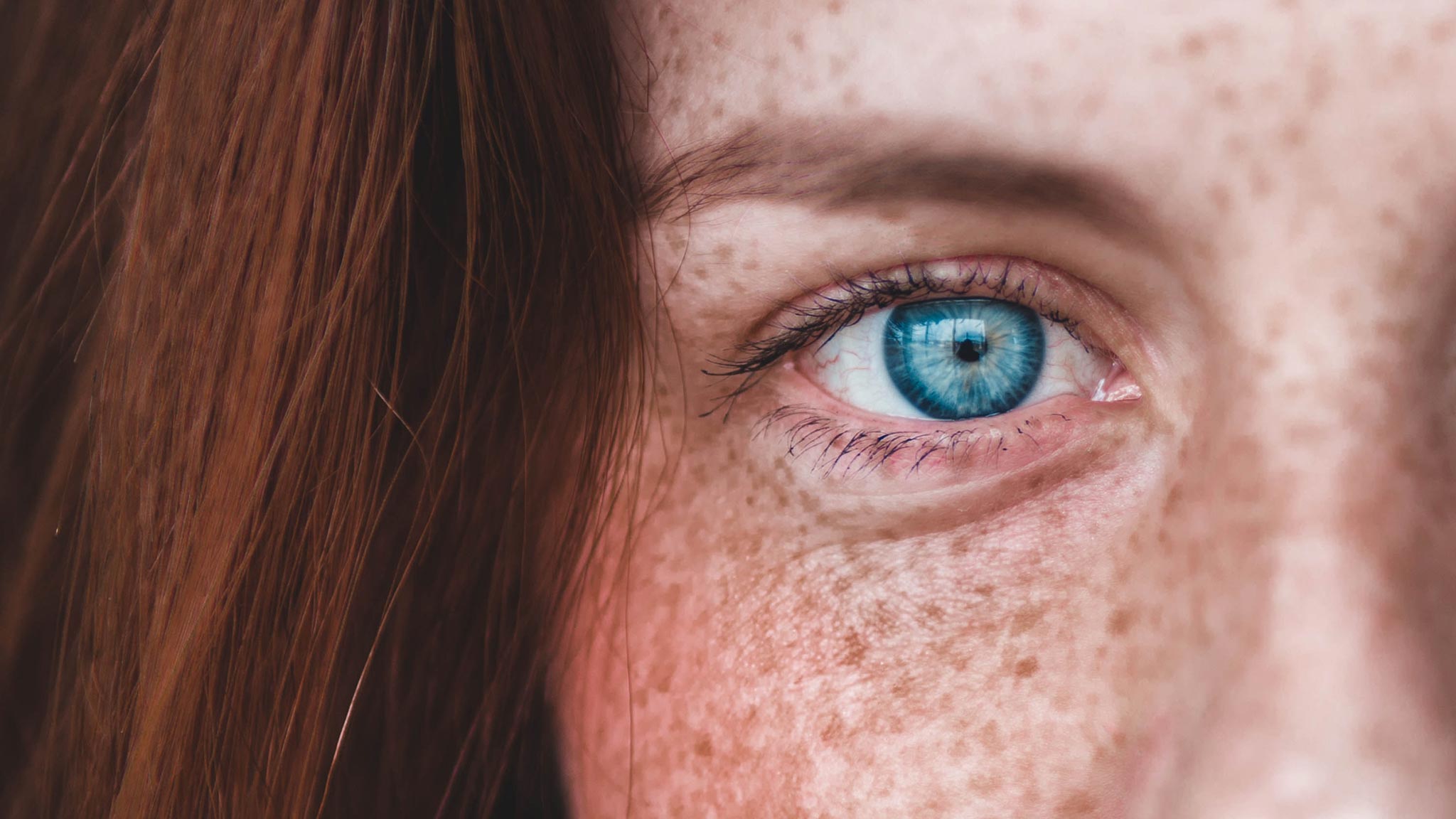 Borderline Personality Disorder & Loneliness Often Go Hand-In-Hand Closeup Photograph Of Freckled Woman Staring Intently Into The Camera Lens