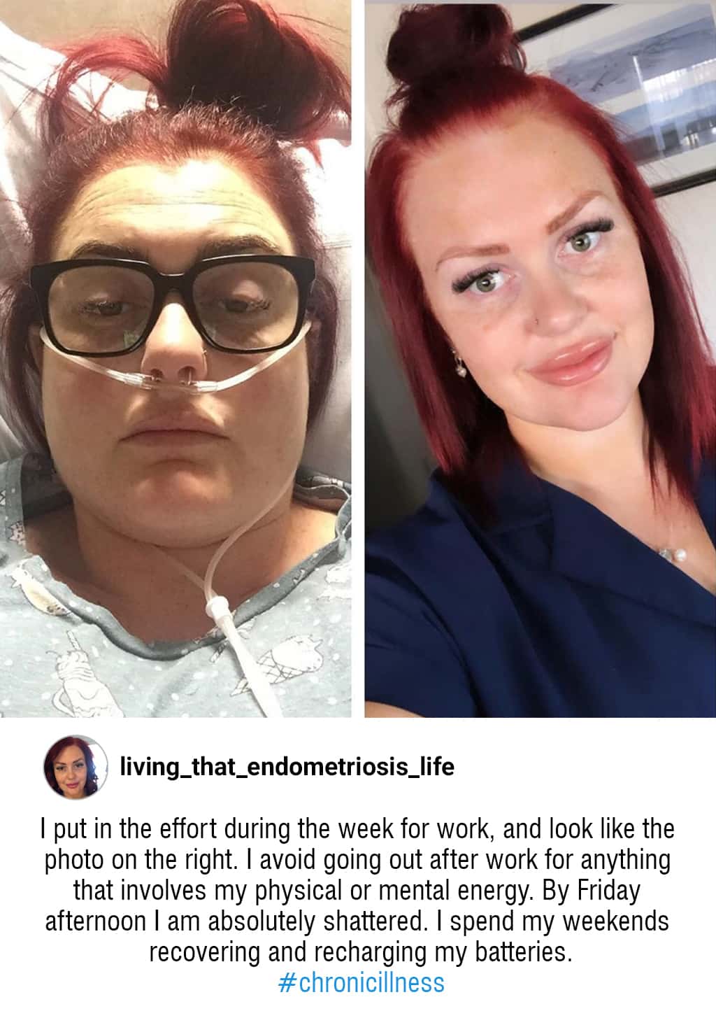 an instagram post of a woman living that endometriosis life and a written caption explanation the reason for her isolation due to her disability